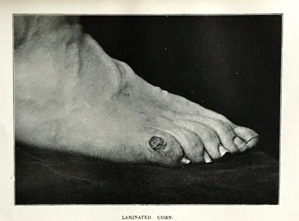 Early Podiatry Book